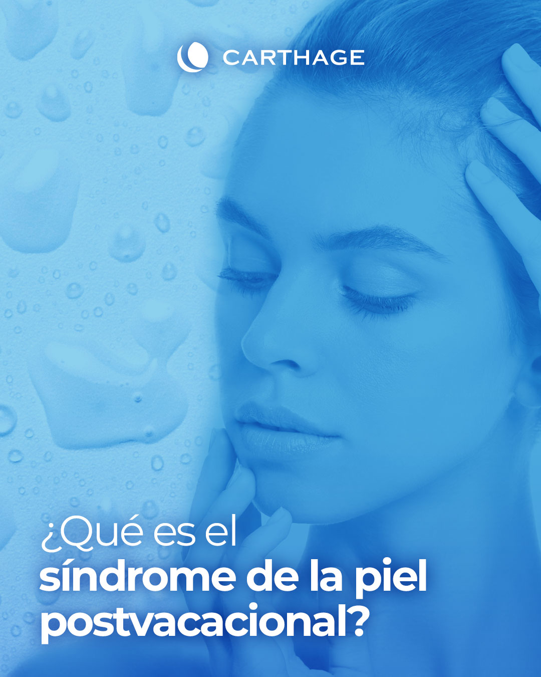¿Qué es el síndrome de la piel postvacacional?